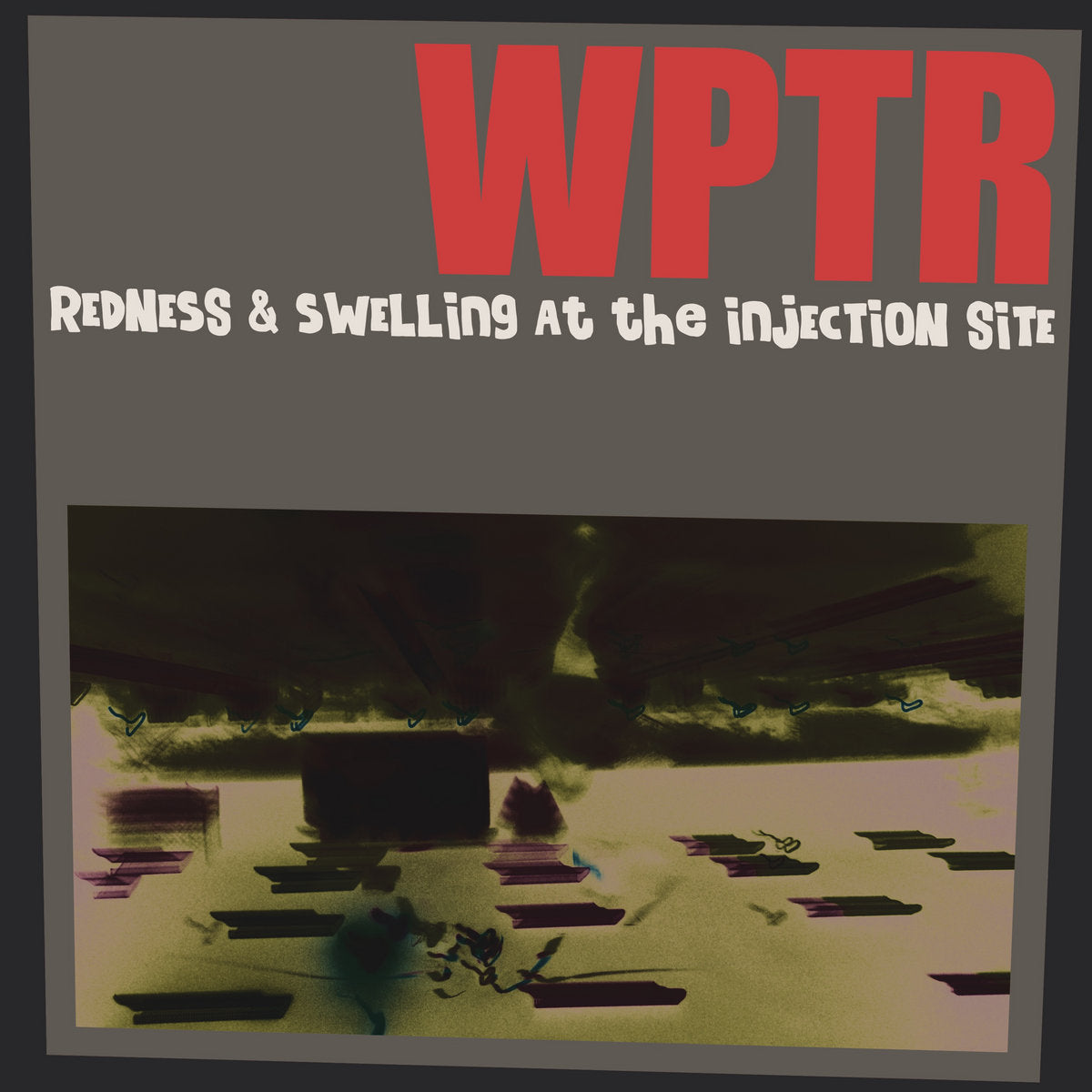 WPTR - Redness & Swelling at the Injection Site (Garage Sale)